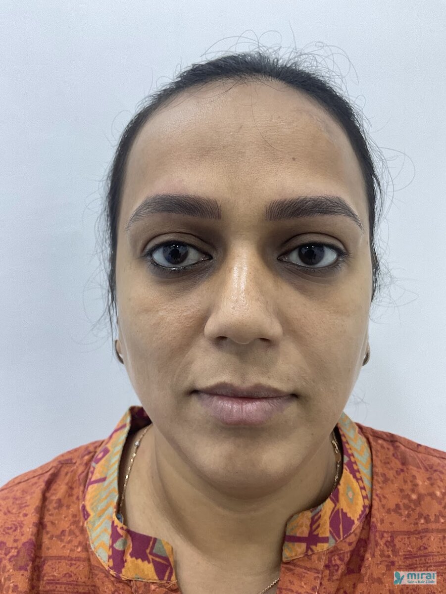 Ami Shah After Microblading