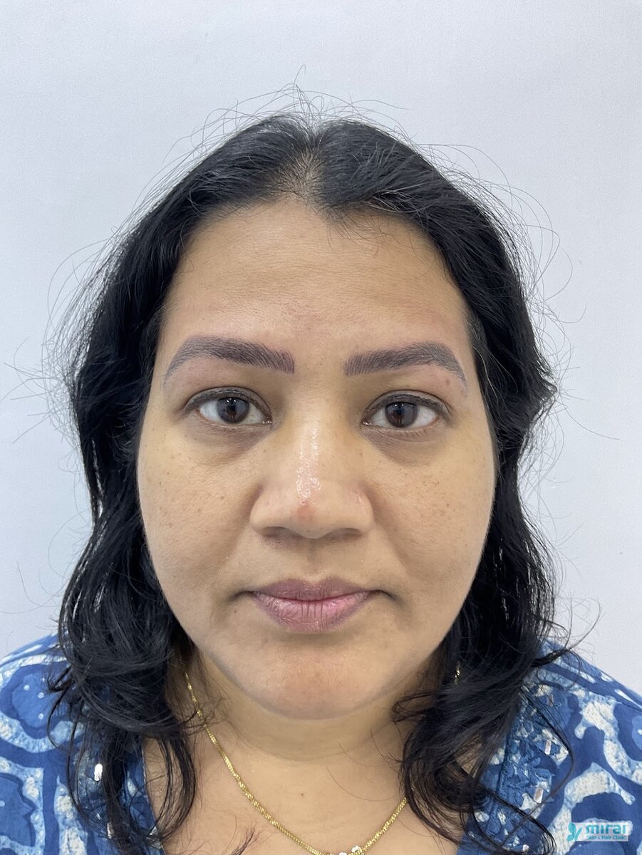 Divya After Microblading