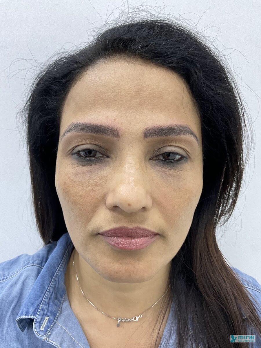 Madhuri Pandit Before Microblading