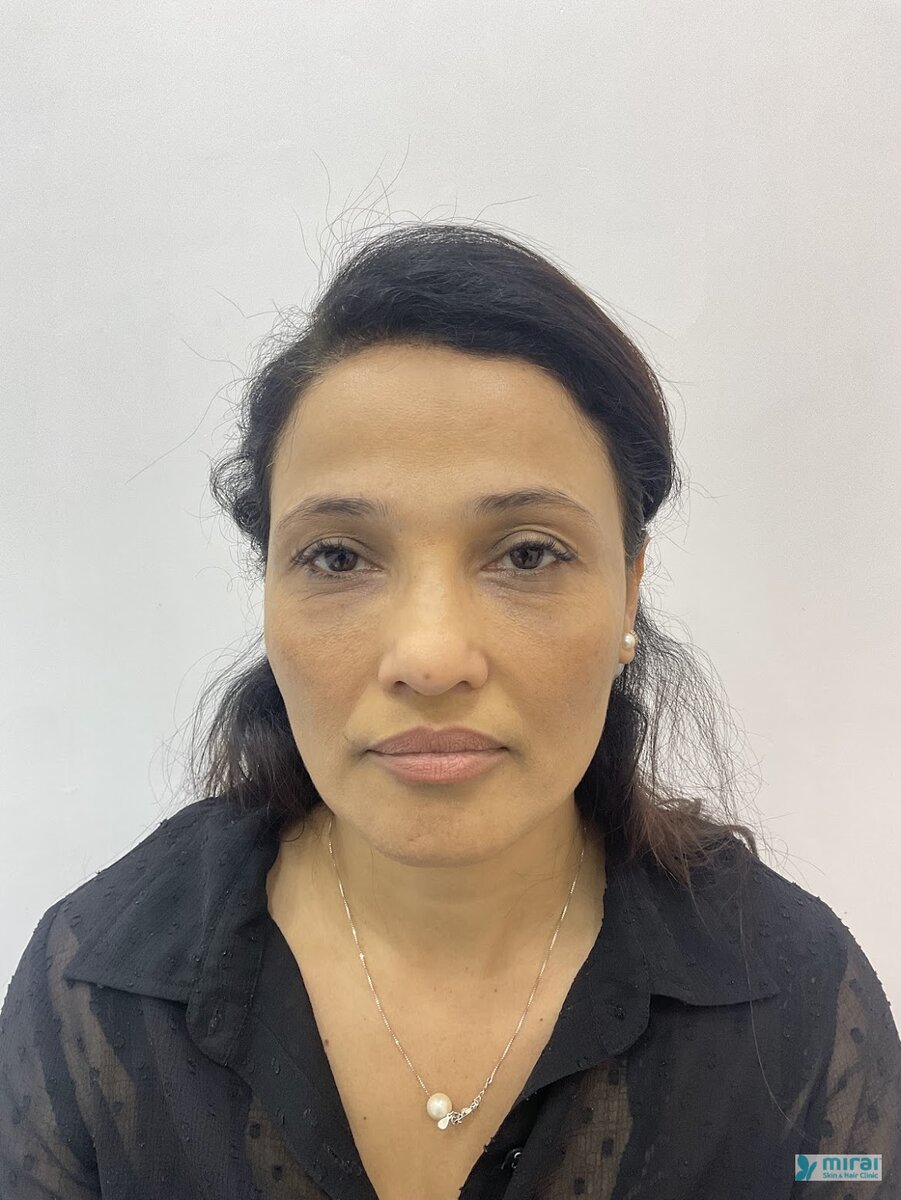 Madhuri Pandit After Microblading
