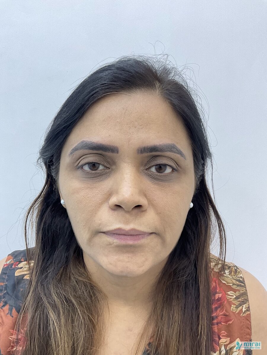 Pooja After Microblading