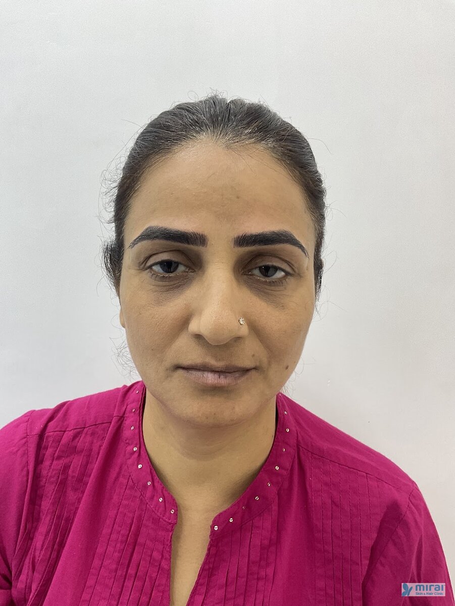 Priti Chauhan After Microblading