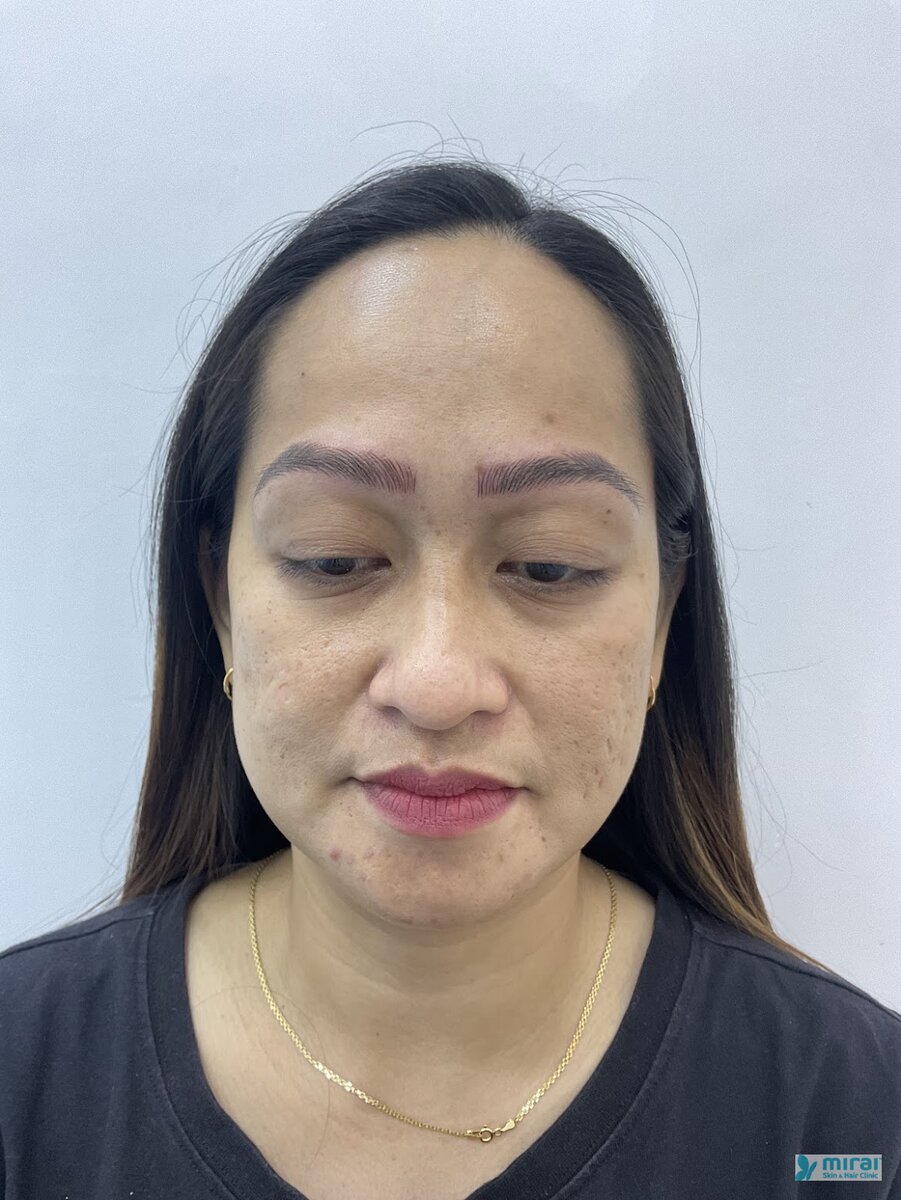 Rinalyn After Microblading