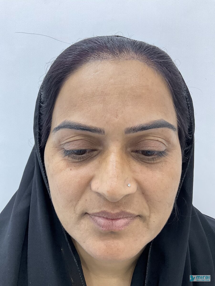Shabanam After Microblading